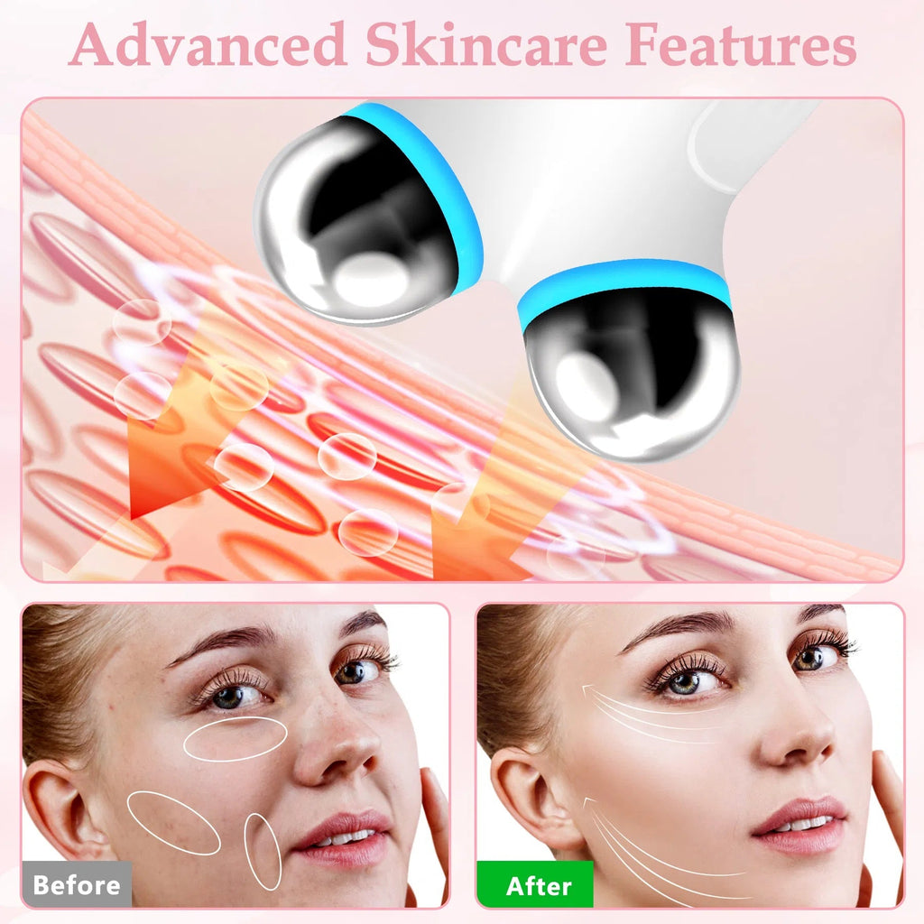 Anti Aging And Wrinkles Microcurrent Facial Device - White